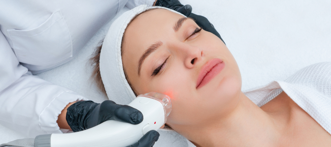 Paciente em tratamento estético facial a laser, exemplo de marketing para clínica de estética que valoriza confiança e resultados.